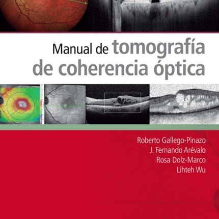 Manual de tomografa de coherencia ptica