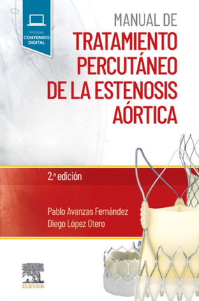Manual de tratamiento percutáneo de la estenosis
