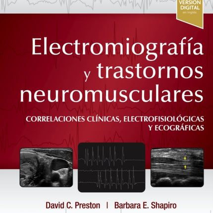 Electromiografa y trastornos neuromusculares
