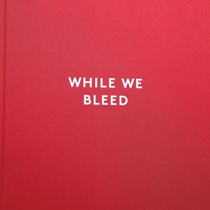 While We Bleed