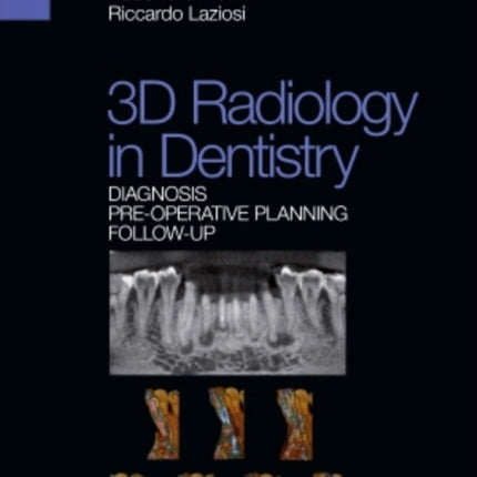 3D radiology in dentistry - Diagnosis Pre-operative Planning Follow-up