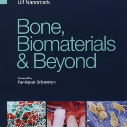 Bone, Biomaterials & Beyond