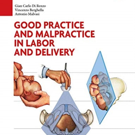 Good Practice and malpractice in labor and delivery