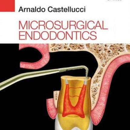 Microsurgical Endodontics