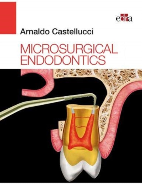 Microsurgical Endodontics