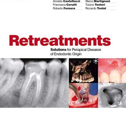 Retreatment. Solutions for apical diseases of endodontic origin