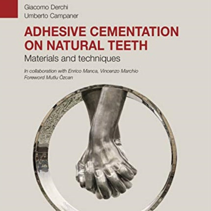 Adhesive cementation on natural teeth - Materials and techniques