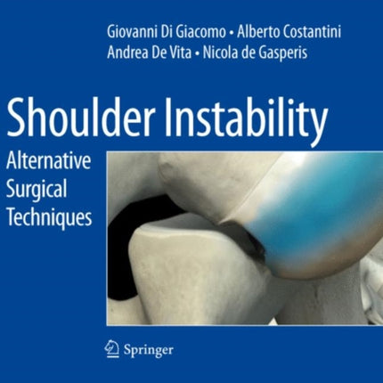 Shoulder Instability: Alternative Surgical Techniques