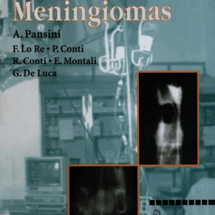 Spinal Meningiomas