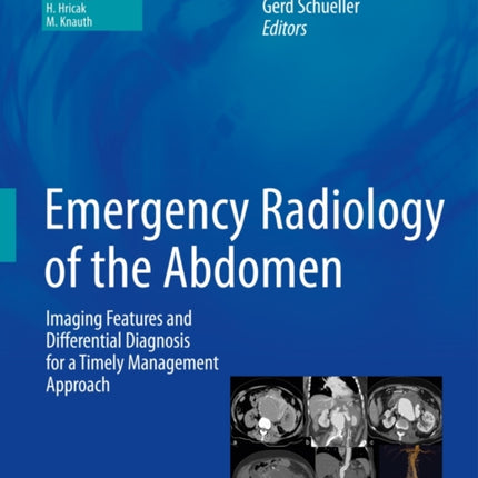 Emergency Radiology of the Abdomen: Imaging Features and Differential Diagnosis for a Timely Management Approach