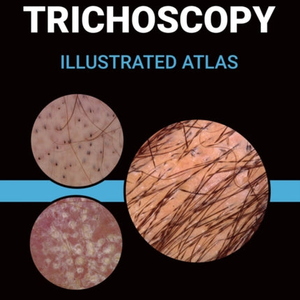 Trichoscopy