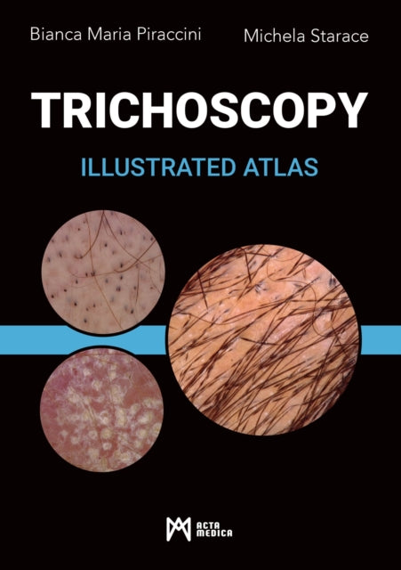 Trichoscopy