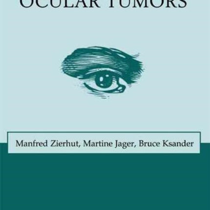 Immunology of Ocular Tumors