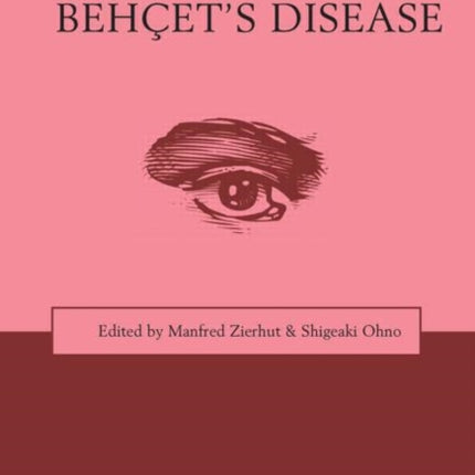 Immunology of Behçet's Disease