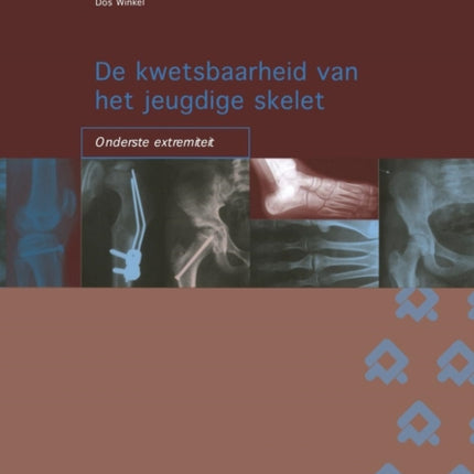 de Kwetsbaarheid Van Het Jeugdige Skelet: Onderste Extremiteit