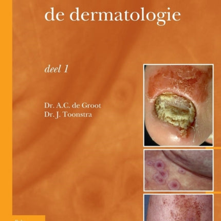 Casuïstiek in de Dermatologie - Deel I