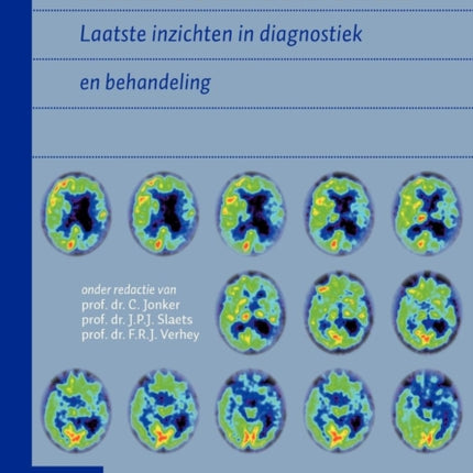 Handboek Dementie: Laatste Inzichten in Diagnostiek En Behandeling