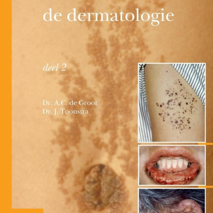 Casuïstiek in de Dermatologie - Deel 2