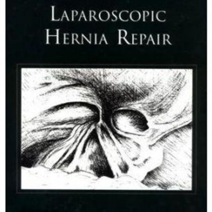 Laparoscopic Hernia Repair