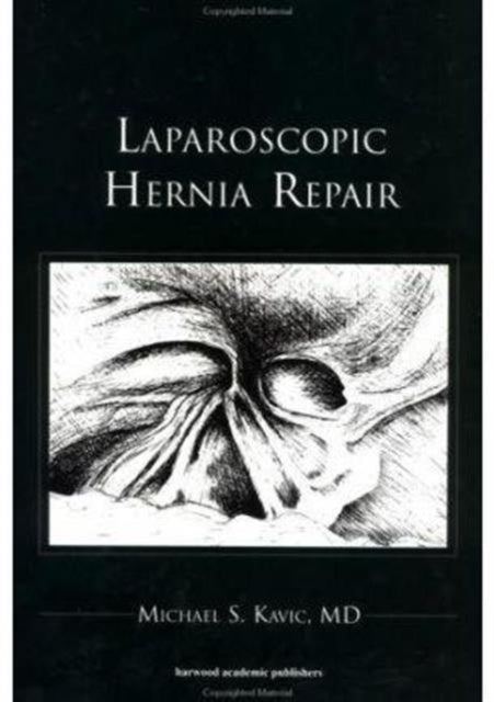 Laparoscopic Hernia Repair