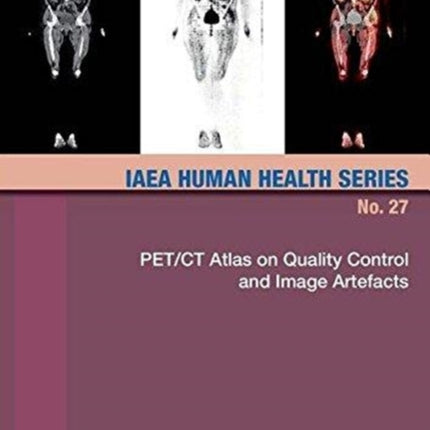 PETCT Atlas on Quality Control and Image