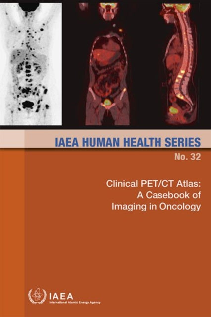Clinical PETCT Atlas a casebook of imaging in