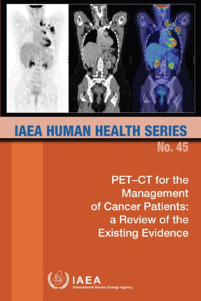 PET-CT for the Management of Cancer Patients: a