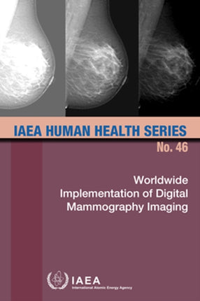 Worldwide Implementation of Digital Mammography