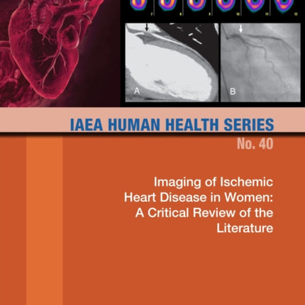 Imaging of Ischemic Heart Disease in Women: A