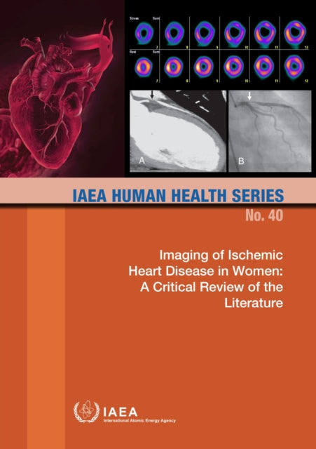 Imaging of Ischemic Heart Disease in Women: A