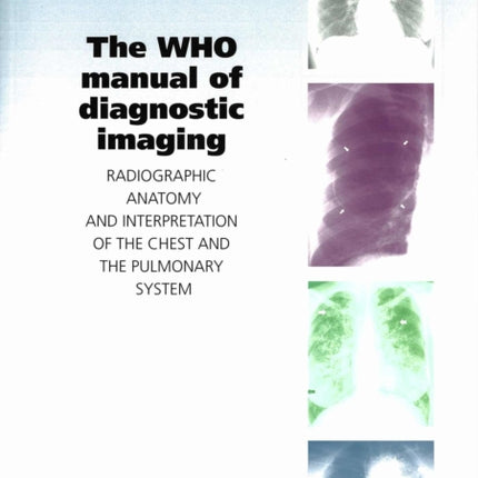 The WHO Manual of Diagnostic Imaging: