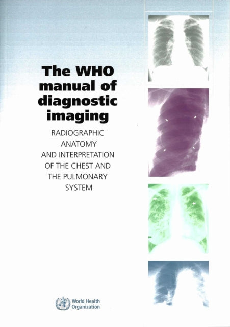 The WHO Manual of Diagnostic Imaging: Radiographic Anatomy and Interpretation of the Chest