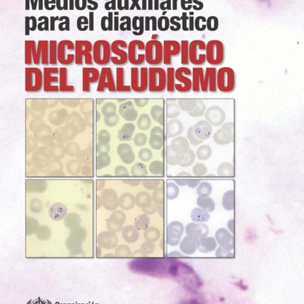 Medios Auxiliares Para El Diagnóstico Microscópico del Paludismo