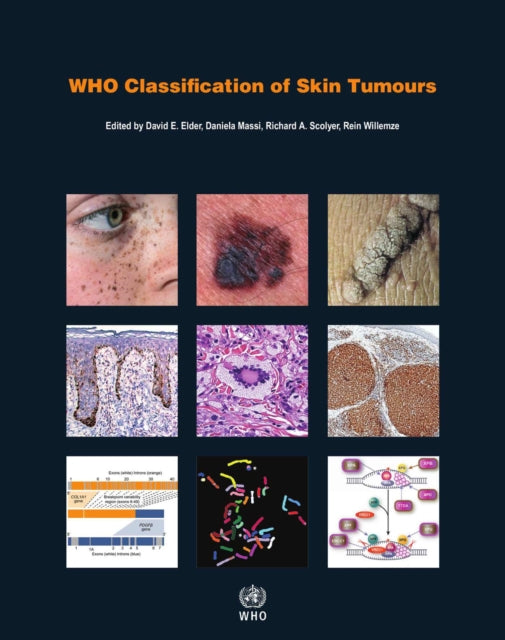 WHO Classification of Skin Tumours: WHO Classification of Tumours, Volume 11