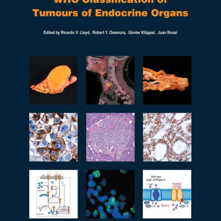 WHO classification of tumours of endocrine organs