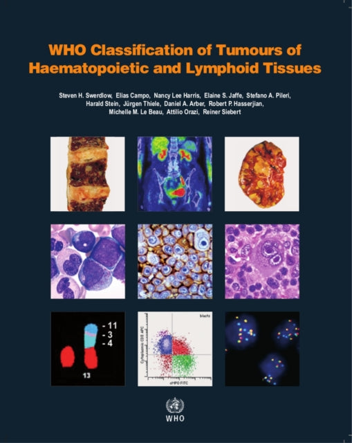 WHO classification of tumours of haematopoietic and lymphoid tissues: Vol. 2