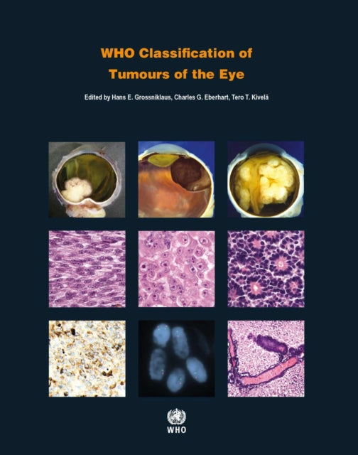 WHO Classification of Tumours of the Eye: WHO Classification of Tumours, Volume 12