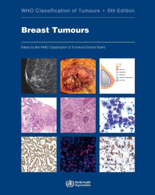 WHO Classification of Breast Tumours: WHO Classification of Tumours, Volume 2