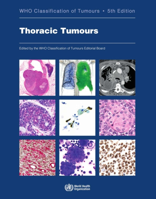 Thoracic tumours