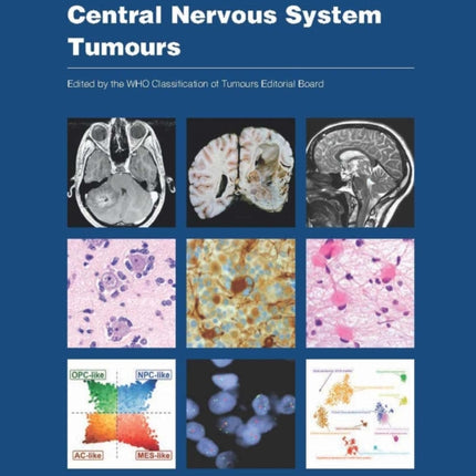 WHO classification of tumours of the central nervous system