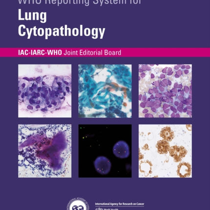 WHO Reporting System for Lung Cytopathology