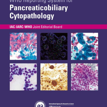 WHO reporting system for Pancreaticobiliary Cytopathology