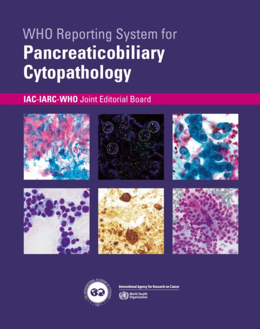 WHO reporting system for Pancreaticobiliary Cytopathology