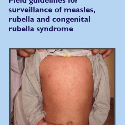 Field guidelines for surveillance of Measles, Rubella and Congenital Rubella Syndrome