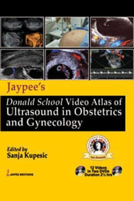 Jaypees Donald School Video Atlas of Ultrasound in Obstetrics and Gynecology