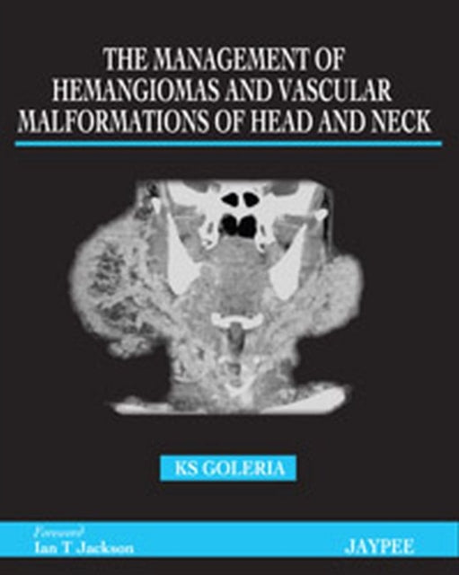 The Management of Haemangiomas and Vascular