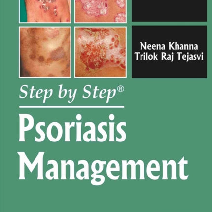 Step by Step: Psoriasis Management