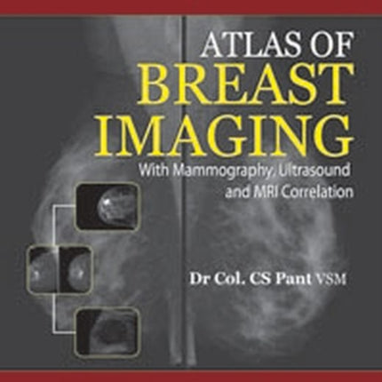 Atlas of Breast Imaging