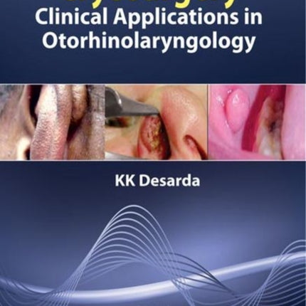 Cryosurgery: Clinical Applications in Otorhinolaryngology