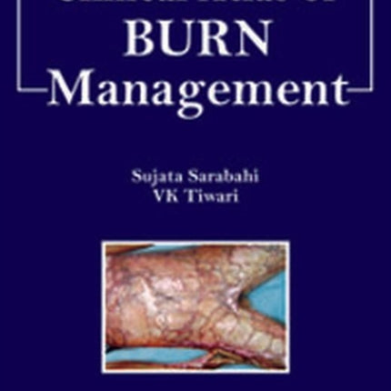 Clinical Atlas of Burn Managment